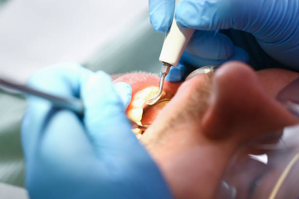 Best Broken or Cracked Tooth Emergency Dentist in Conneaut, OH